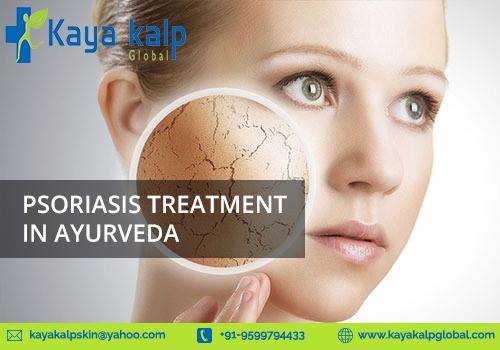 psoriasis treatment in ayurveda