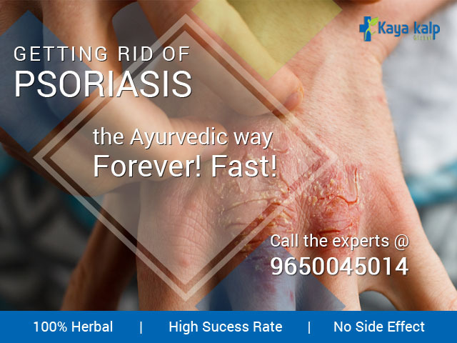 Best Psoriasis Treatment in India